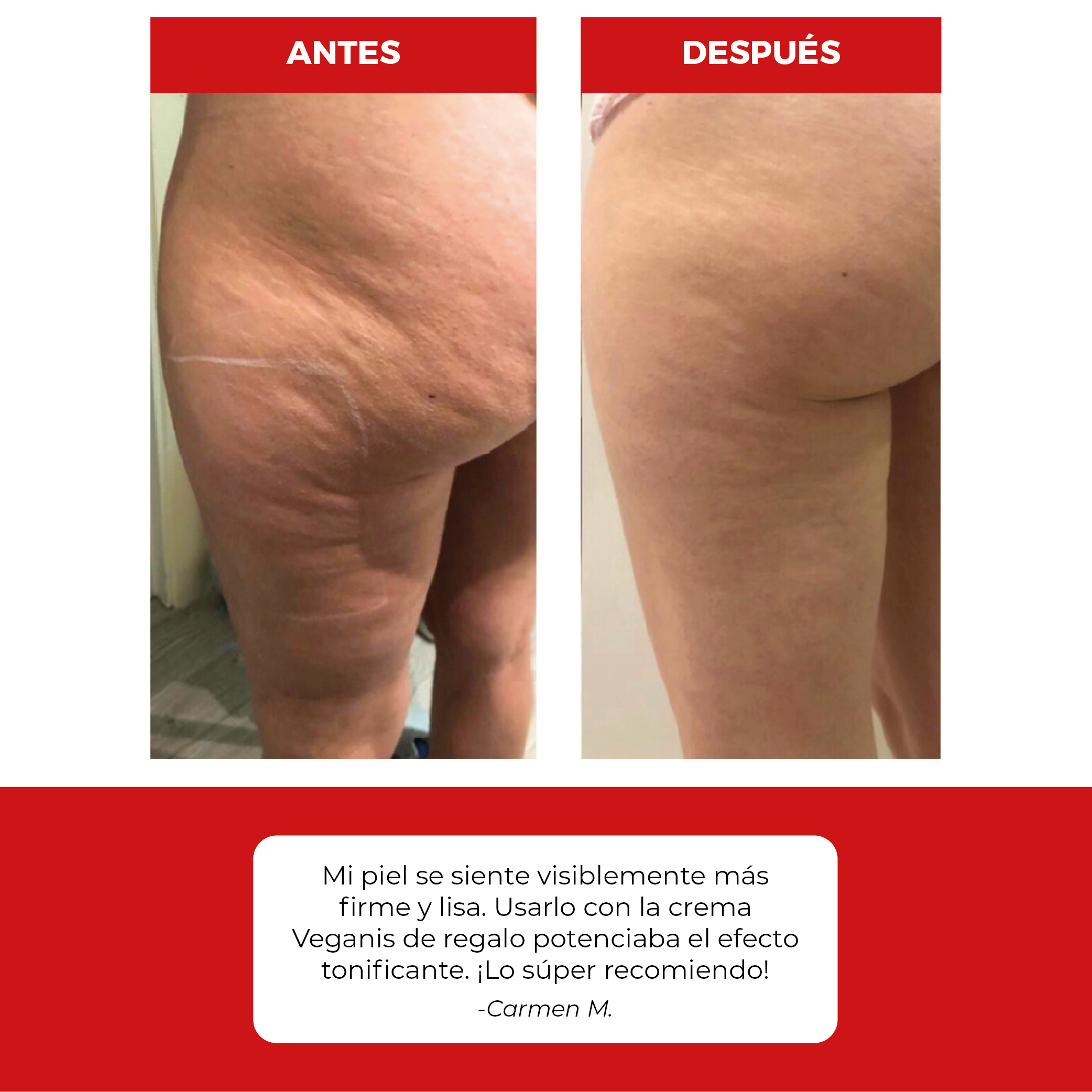 Masajeador Anticelulitis 4 en 1 + Crema Anticelulitis de Regalo